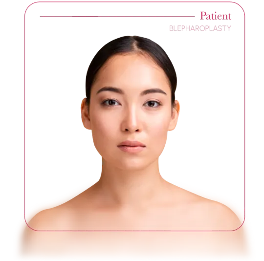Blepharoplasty patient
